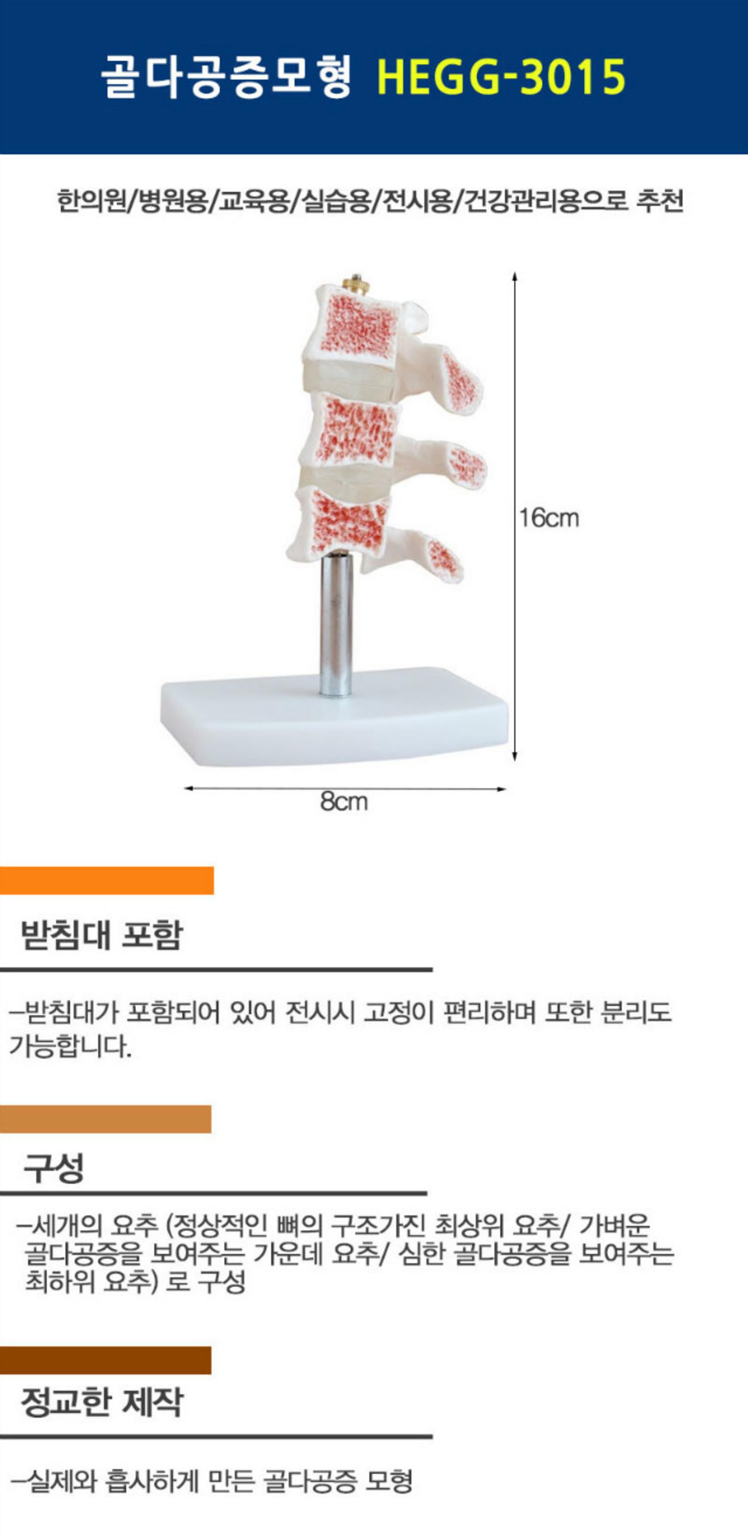 [한의]골다공증 모형